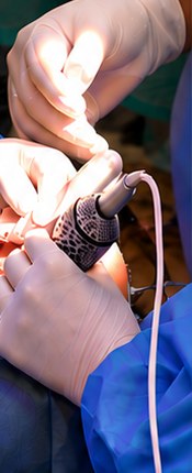 Cirugía implantológica asistida en la Facultad de Odontología UCM